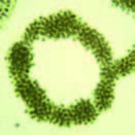 Общий вид колонии Microcystis aeruginosa (по: J. Komárek, 2006).